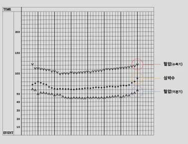 麻醉中、手術結束後即時監測
患者狀態並應對緊急情況