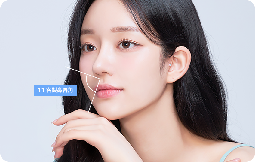 1:1 customized nasolabial angle