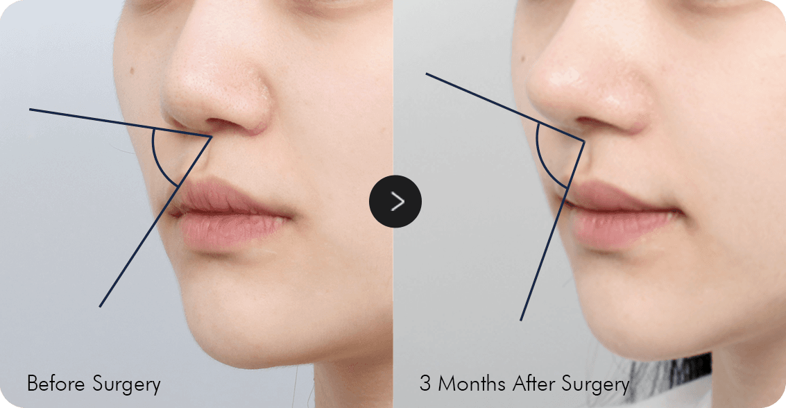 AB Plastic Surgery