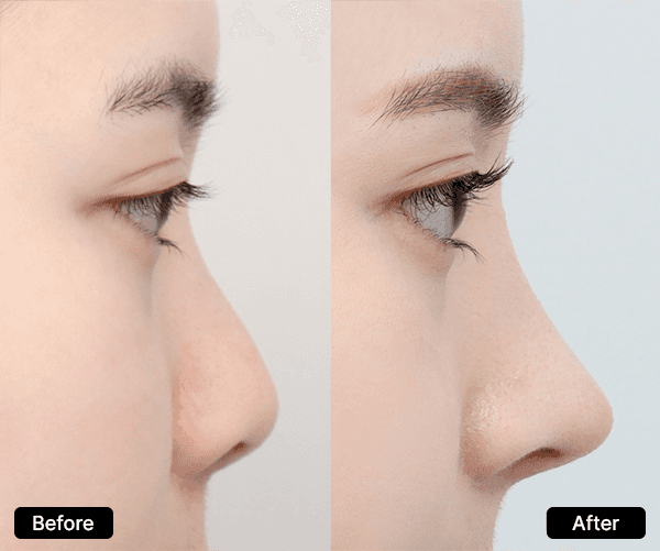 AB Plastic Surgery