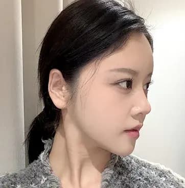 術後3个月