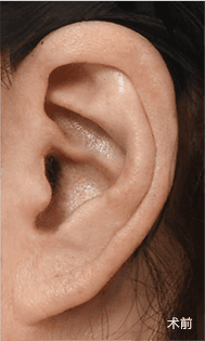 Skill matters in post-surgery scarring too. 1