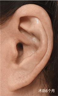 Skill matters in post-surgery scarring too. 3