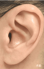 Skill matters in post-surgery scarring too. 1