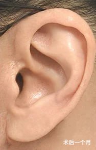 Skill matters in post-surgery scarring too. 2