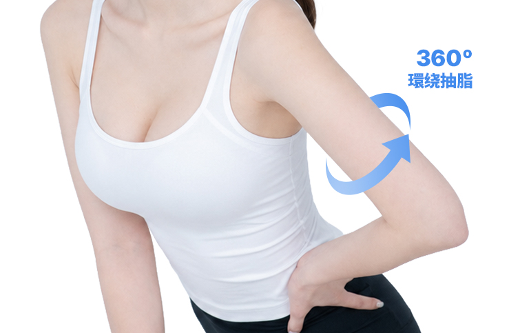 360-degree circumferential arm liposuction