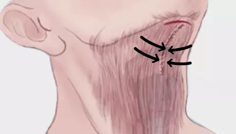 필터를 활용허여 불순물 제거