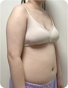 맥미걸 악플콜렉터 Before후 사진