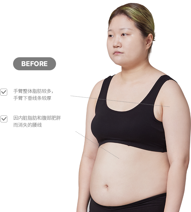 맥미걸 악플콜렉터 바디 수술 전 문제점과 개선점