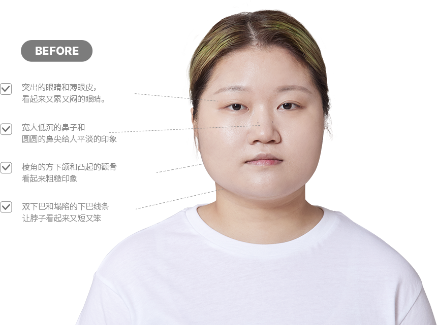 맥미걸 악플콜렉터 얼굴 수술 전 문제점과 개선점