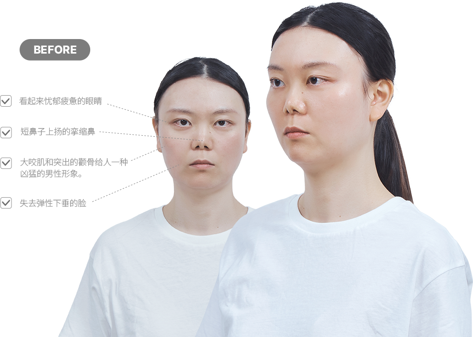 맥미걸 악플콜렉터 얼굴 수술 전 문제점과 개선점