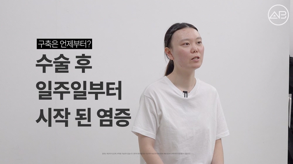 맥미걸 MAKE ME GIRL 수술 전