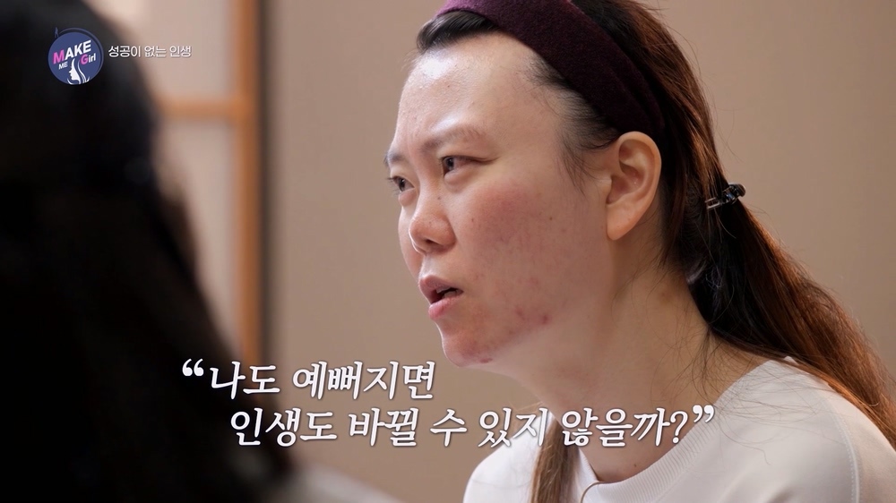 맥미걸 MAKE ME GIRL 수술 전