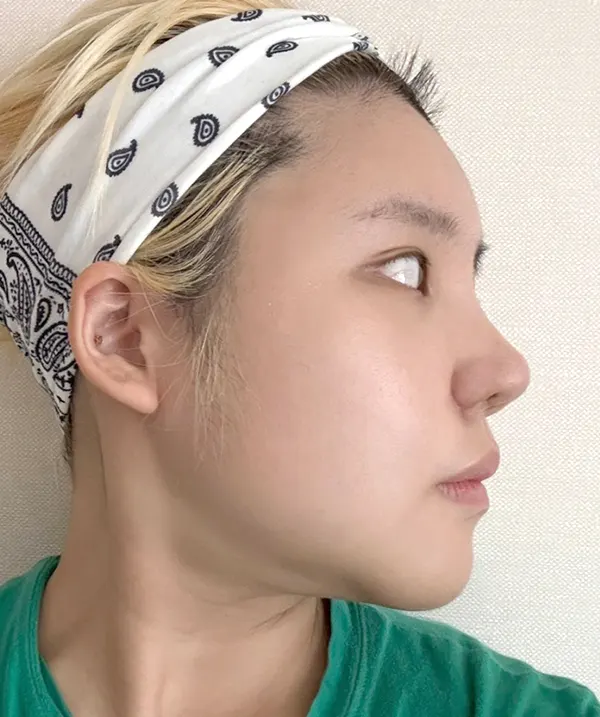 맥미걸 악플콜렉터 Before후 사진