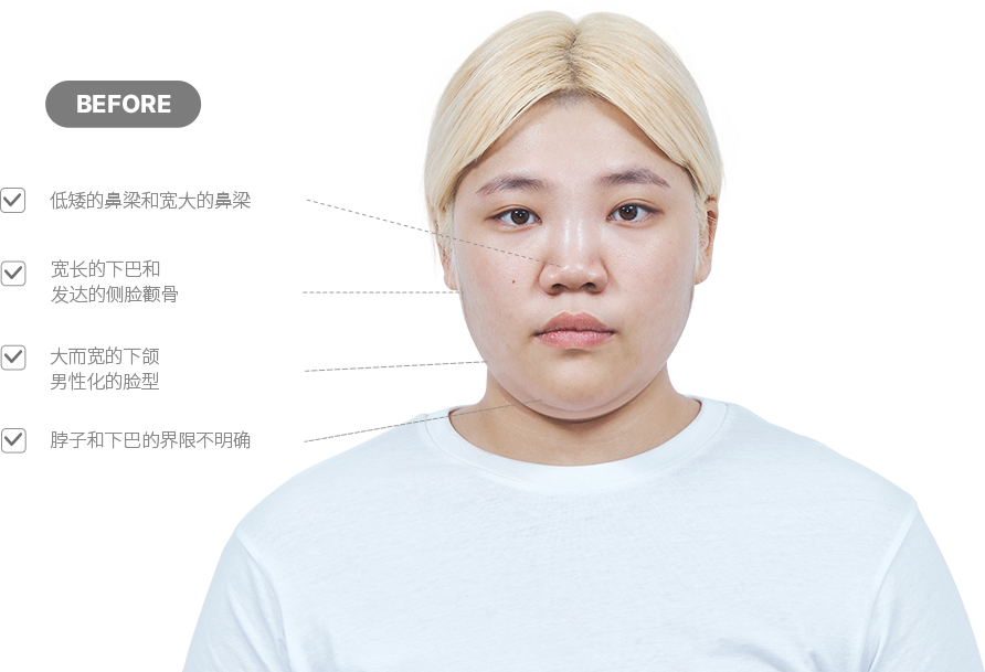 맥미걸 악플콜렉터 얼굴 수술 전 문제점과 개선점