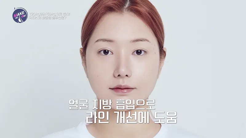 맥미걸 MAKE ME GIRL 수술 후