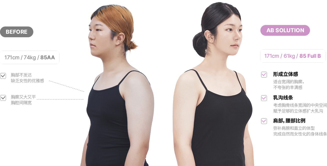 맥미걸 악플콜렉터 얼굴 수술 전 문제점과 개선점