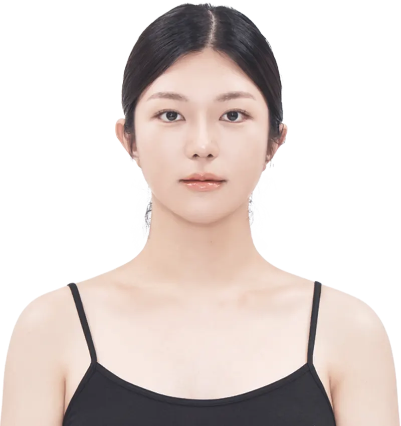 맥미걸 악플콜렉터 수술 후 사진